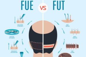 fue vs fut