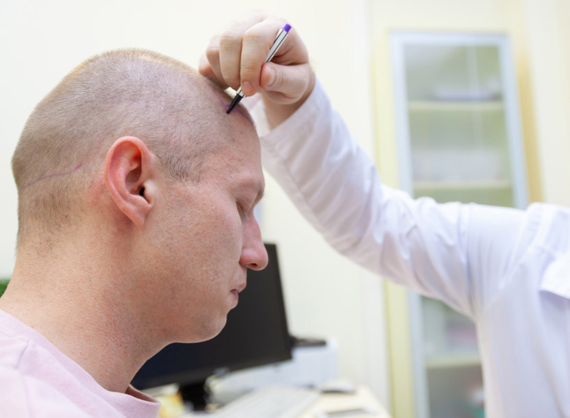 CHOOSING THE RIGHT CLINIC - Hair Transplant Turkey